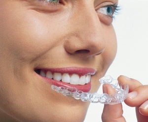 Invisalign_Trio1-1.jpg